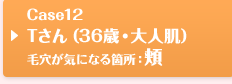 Case12 Tさん（36歳・大人肌）毛穴が気になる箇所：頬