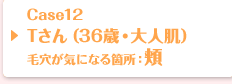 Case12 Tさん（36歳・大人肌）毛穴が気になる箇所：頬