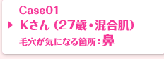 Case01 Kさん（27歳・混合肌）毛穴が気になる箇所：鼻