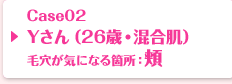 Case02 Yさん（26歳・混合肌）毛穴が気になる箇所：頬