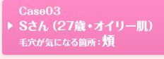 Case03 Sさん（27歳・オイリー肌）毛穴が気になる箇所：頬