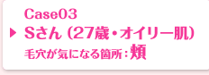 Case03 Sさん（27歳・オイリー肌）毛穴が気になる箇所：頬