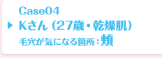 Case04 Kさん（27歳・乾燥肌）毛穴が気になる箇所：頬