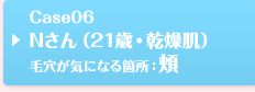 Case06 Nさん（21歳・乾燥肌）毛穴が気になる箇所：頬
