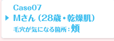 Case07 Mさん（28歳・乾燥肌）毛穴が気になる箇所：頬