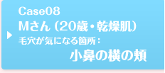 Case08 Mさん（20歳・普通肌）毛穴が気になる箇所：小鼻の横の頬