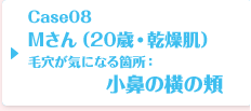 Case08 Mさん（20歳・普通肌）毛穴が気になる箇所：小鼻の横の頬