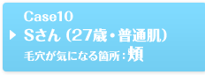 Case10 Sさん（27歳・普通肌）毛穴が気になる箇所：頬