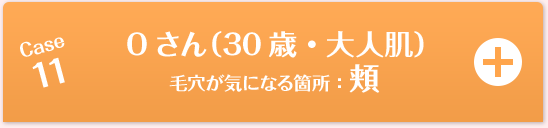 Case11 Oさん（26歳・大人肌）毛穴が気になる箇所：頬