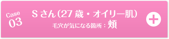 Case03 Sさん（27歳・オイリー肌）毛穴が気になる箇所：頬