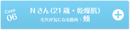 Case06 Nさん（21歳・乾燥肌）毛穴が気になる箇所：頬