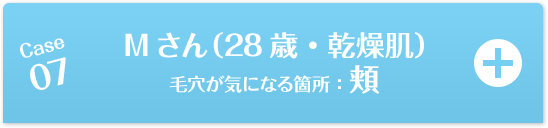 Case07 Mさん（28歳・乾燥肌）毛穴が気になる箇所：頬