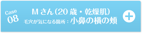 Case08 Mさん（20歳・乾燥肌）毛穴が気になる箇所：小鼻の横の頬