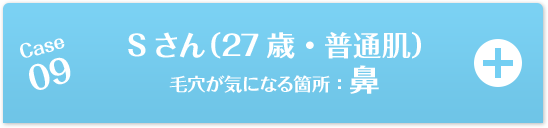 Case09 Sさん（27歳・普通肌）毛穴が気になる箇所：鼻